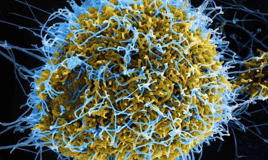 عاجل | تسجل أول حالة وفاة في العالم بفيروس أوز